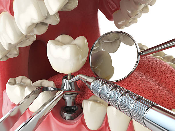 Best Same-Day Emergency Dental Services in Lake Jackson, TX